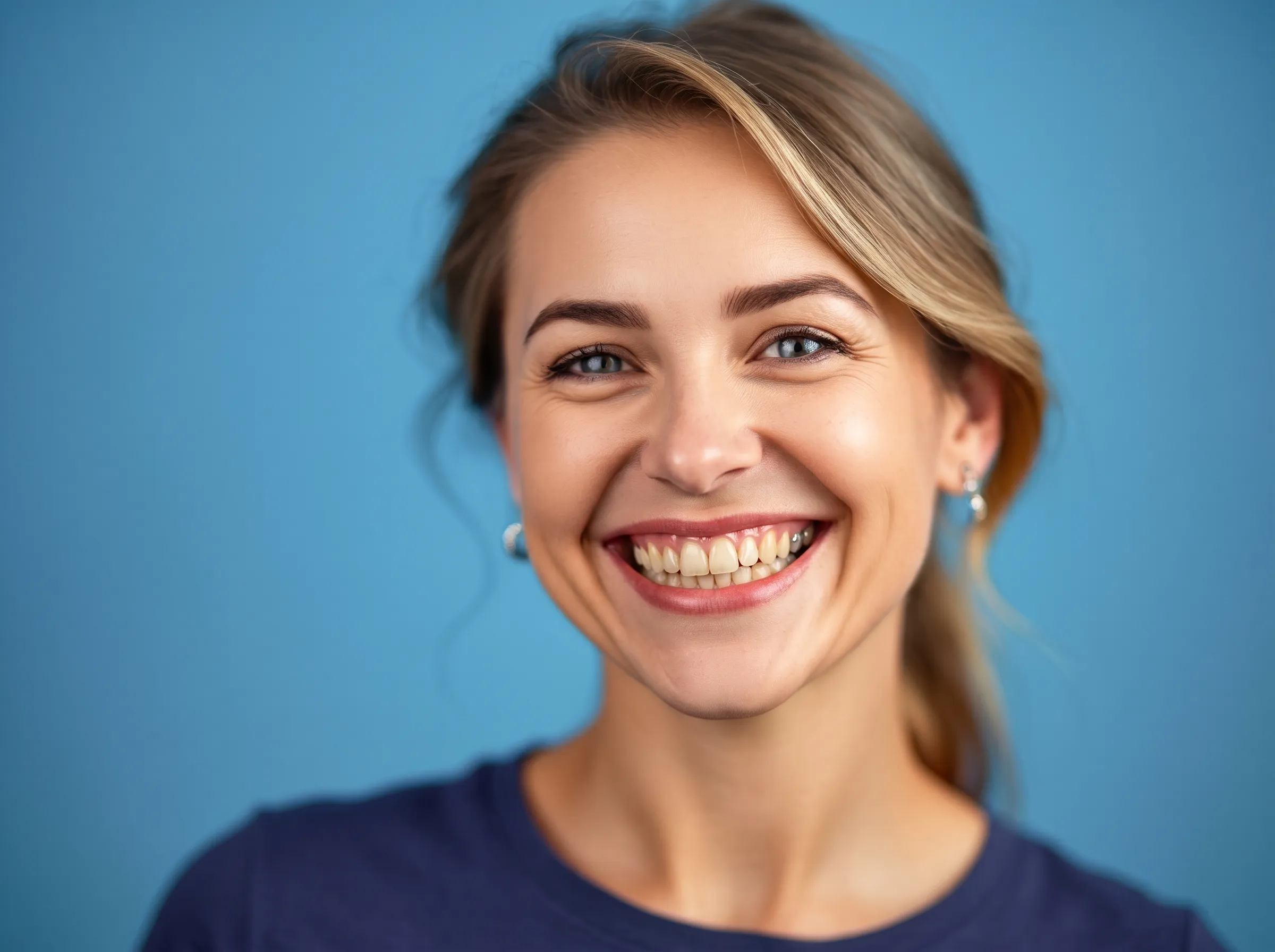 Teeth Whitening Transformation - Before